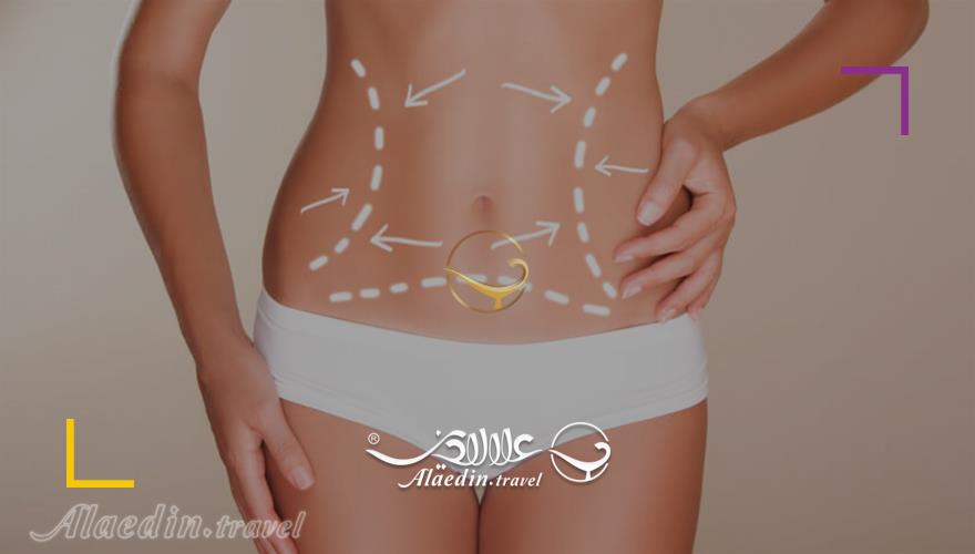 لیپوساکشن و پیکرتراشی در ایران | علاءالدین تراول