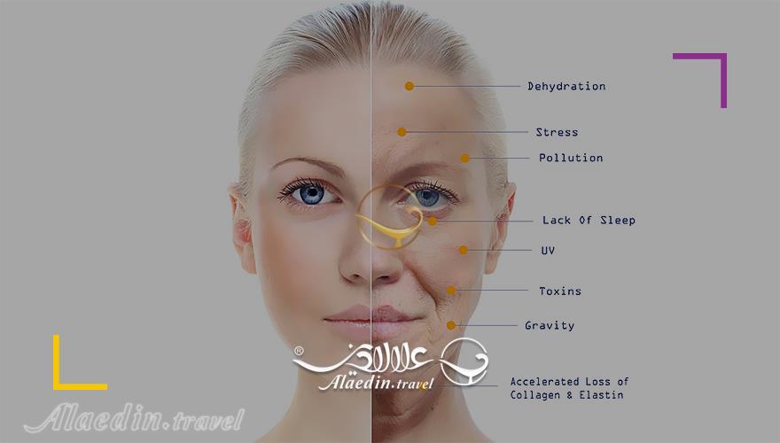 لیفت صورت در ایران | علاءالدین تراول